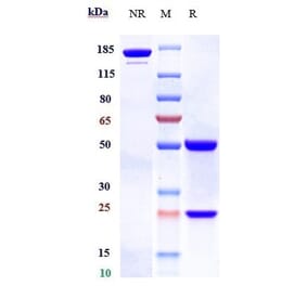SDS-PAGE - Bococizumab Biosimilar - Anti-PCSK9 Antibody - Low endotoxin, Azide free (A323327) - Antibodies.com