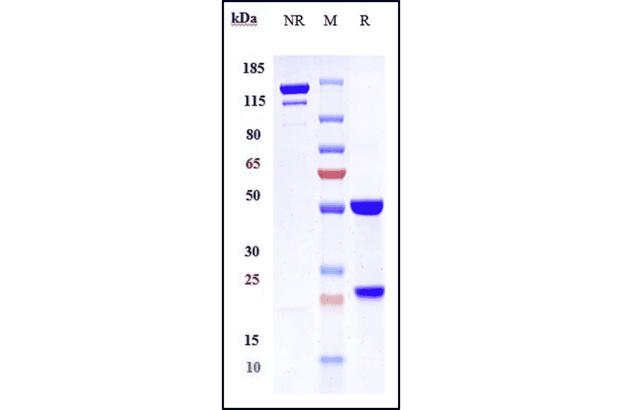 SDS-PAGE - Briakinumab Biosimilar - Anti-IL-12A + IL-12B Antibody - Low endotoxin, Azide free (A323331) - Antibodies.com