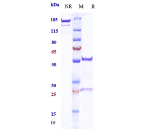 SDS-PAGE - Budigalimab Biosimilar - Anti-PD1 Antibody - Low endotoxin, Azide free (A323334) - Antibodies.com