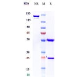 SDS-PAGE - Burosumab Biosimilar - Anti-FGF23 Antibody - Low endotoxin, Azide free (A323335) - Antibodies.com