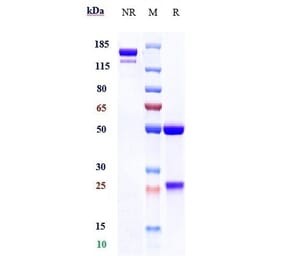 SDS-PAGE - Cabiralizumab Biosimilar - Anti-CSF-1-R Antibody - Low endotoxin, Azide free (A323336) - Antibodies.com