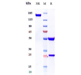 SDS-PAGE - Canakinumab Biosimilar - Anti-IL-1 beta Antibody - Low endotoxin, Azide free (A323339) - Antibodies.com