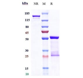 SDS-PAGE - Carlumab Biosimilar - Anti-MCP1 Antibody - Low endotoxin, Azide free (A323344) - Antibodies.com