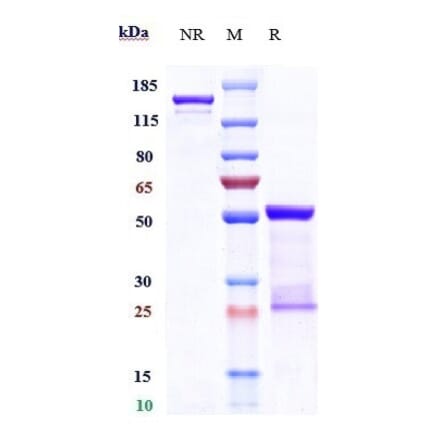 SDS-PAGE - Carlumab Biosimilar - Anti-MCP1 Antibody - Low endotoxin, Azide free (A323344) - Antibodies.com