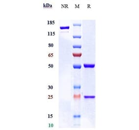 SDS-PAGE - Carotuximab Biosimilar - Anti-CD105 Antibody - Low endotoxin, Azide free (A323346) - Antibodies.com
