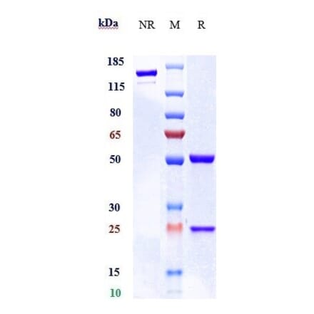 SDS-PAGE - Carotuximab Biosimilar - Anti-CD105 Antibody - Low endotoxin, Azide free (A323346) - Antibodies.com