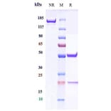 SDS-PAGE - Cergutuzumab Biosimilar - Anti-CEACAM5 Antibody - Low endotoxin, Azide free (A323350) - Antibodies.com