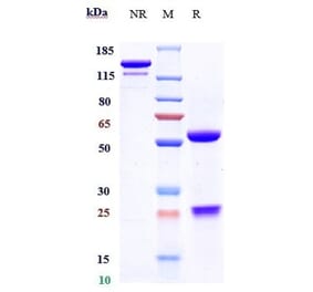 SDS-PAGE - Certolizumab Biosimilar - Anti-TNF alpha Antibody - Low endotoxin, Azide free (A323351) - Antibodies.com