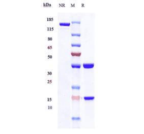 SDS-PAGE - Cetrelimab Biosimilar - Anti-PD1 Antibody - Low endotoxin, Azide free (A323352) - Antibodies.com