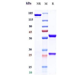 SDS-PAGE - Cetuximab Biosimilar - Anti-EGFR Antibody - Low endotoxin, Azide free (A323354) - Antibodies.com