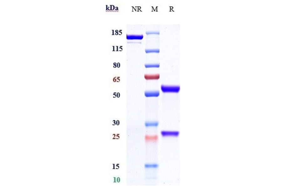 SDS-PAGE - Cetuximab Biosimilar - Anti-EGFR Antibody - Low endotoxin, Azide free (A323354) - Antibodies.com