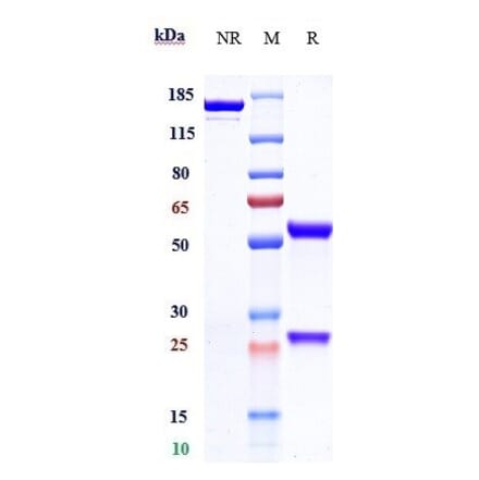 SDS-PAGE - Cetuximab Biosimilar - Anti-EGFR Antibody - Low endotoxin, Azide free (A323354) - Antibodies.com