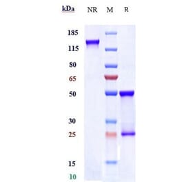 SDS-PAGE - Cevostamab Biosimilar - Anti-FCRL5 Antibody - Low endotoxin, Azide free (A323356) - Antibodies.com