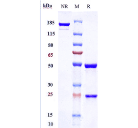 SDS-PAGE - Clazakizumab Biosimilar - Anti-IL-6 Antibody - Low endotoxin, Azide free (A323360) - Antibodies.com