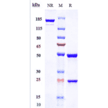 SDS-PAGE - Clazakizumab Biosimilar - Anti-IL-6 Antibody - Low endotoxin, Azide free (A323360) - Antibodies.com