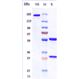 SDS-PAGE - Codrituzumab Biosimilar - Anti-Glypican 3 Antibody - Low endotoxin, Azide free (A323365) - Antibodies.com