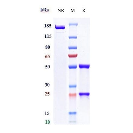 SDS-PAGE - Coltuximab Biosimilar - Anti-CD19 Antibody - Low endotoxin, Azide free (A323367) - Antibodies.com