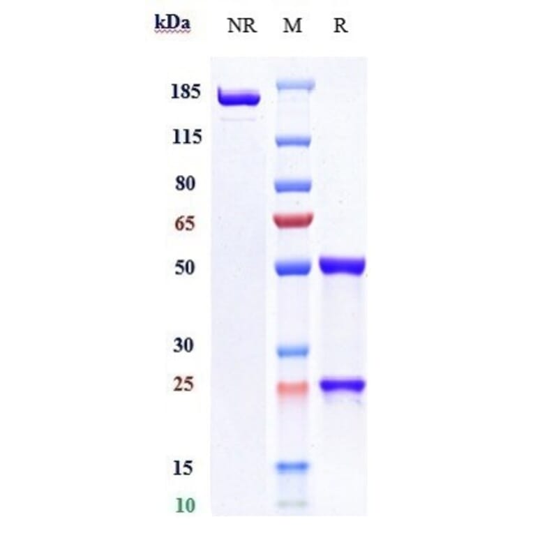 SDS-PAGE - Coltuximab Biosimilar - Anti-CD19 Antibody - Low endotoxin, Azide free (A323367) - Antibodies.com