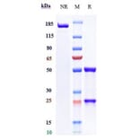 SDS-PAGE - Coltuximab Biosimilar - Anti-CD19 Antibody - Low endotoxin, Azide free (A323367) - Antibodies.com