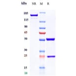 SDS-PAGE - Conatumumab Biosimilar - Anti-DR5 Antibody - Low endotoxin, Azide free (A323368) - Antibodies.com
