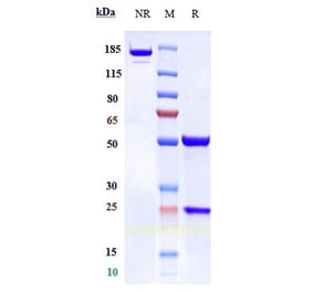 SDS-PAGE - Concizumab Biosimilar - Anti-TFPI Antibody - Low endotoxin, Azide free (A323369) - Antibodies.com