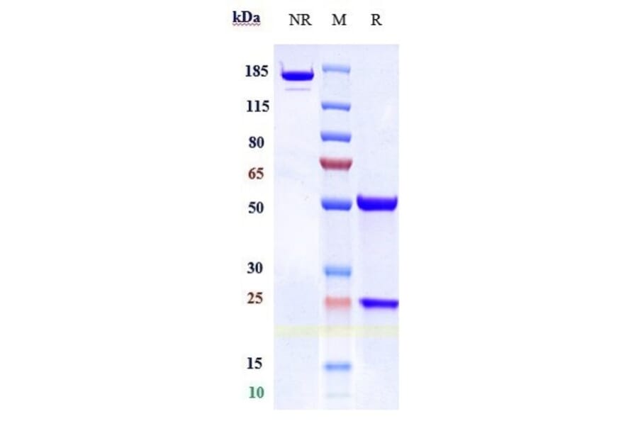 SDS-PAGE - Concizumab Biosimilar - Anti-TFPI Antibody - Low endotoxin, Azide free (A323369) - Antibodies.com