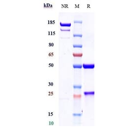 SDS-PAGE - Cosibelimab Biosimilar - Anti-PD-L1 Antibody - Low endotoxin, Azide free (A323371) - Antibodies.com