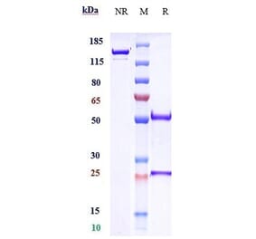 SDS-PAGE - Crenezumab Biosimilar - Anti-beta Amyloid Antibody - Low endotoxin, Azide free (A323372) - Antibodies.com