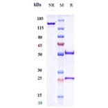 SDS-PAGE - Crenezumab Biosimilar - Anti-beta Amyloid Antibody - Low endotoxin, Azide free (A323372) - Antibodies.com