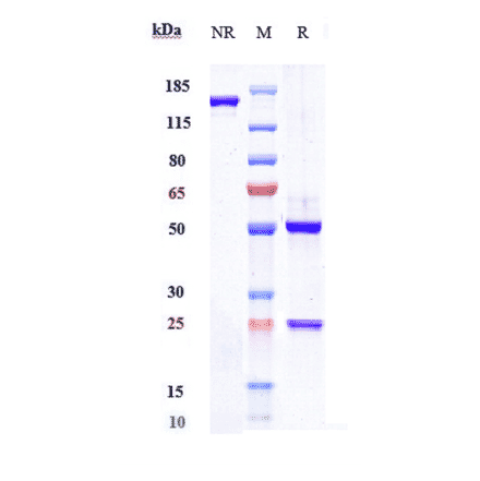SDS-PAGE - Crizanlizumab Biosimilar - Anti-CD62P Antibody - Low endotoxin, Azide free (A323373) - Antibodies.com