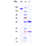 SDS-PAGE - Crizanlizumab Biosimilar - Anti-CD62P Antibody - Low endotoxin, Azide free (A323373) - Antibodies.com