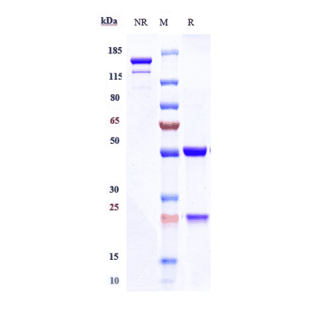 SDS-PAGE - Cusatuzumab Biosimilar - Anti-CD70 Antibody - Low endotoxin, Azide free (A323377) - Antibodies.com