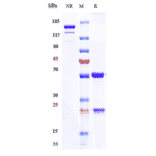 SDS-PAGE - Cusatuzumab Biosimilar - Anti-CD70 Antibody - Low endotoxin, Azide free (A323377) - Antibodies.com