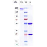 SDS-PAGE - Dacetuzumab Biosimilar - Anti-CD40 Antibody - Low endotoxin, Azide free (A323378) - Antibodies.com