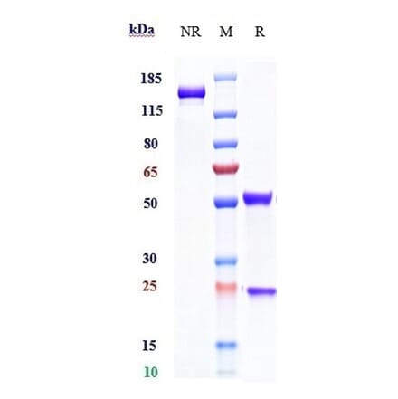 SDS-PAGE - Daclizumab Biosimilar - Anti-IL-2 Receptor alpha Antibody - Low endotoxin, Azide free (A323379) - Antibodies.com