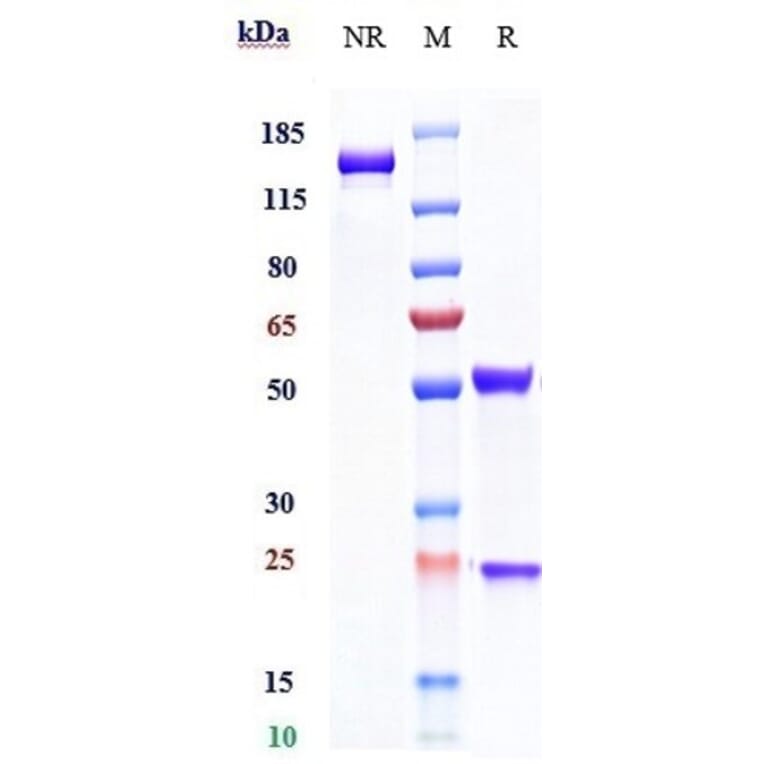 SDS-PAGE - Daclizumab Biosimilar - Anti-IL-2 Receptor alpha Antibody - Low endotoxin, Azide free (A323379) - Antibodies.com