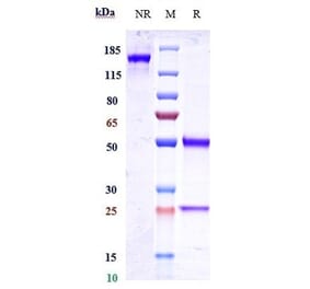 SDS-PAGE - Dalotuzumab Biosimilar - Anti-IGF1 Receptor Antibody - Low endotoxin, Azide free (A323380) - Antibodies.com
