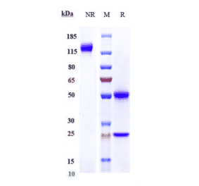 SDS-PAGE - Demcizumab Biosimilar - Anti-DLL4 Antibody - Low endotoxin, Azide free (A323386) - Antibodies.com