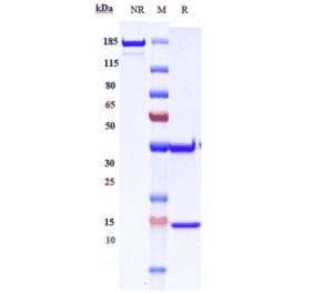 SDS-PAGE - Demupitamab Biosimilar - Anti-EGFR Antibody - Low endotoxin, Azide free (A323387) - Antibodies.com