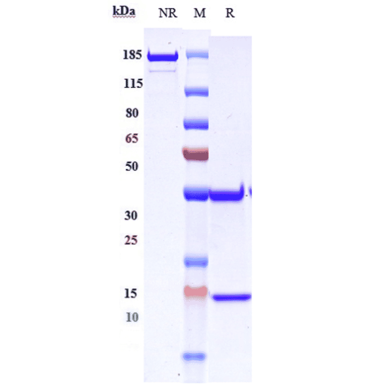 SDS-PAGE - Demupitamab Biosimilar - Anti-EGFR Antibody - Low endotoxin, Azide free (A323387) - Antibodies.com