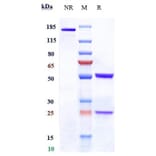 SDS-PAGE - Denintuzumab Biosimilar - Anti-CD19 Antibody - Low endotoxin, Azide free (A323388) - Antibodies.com