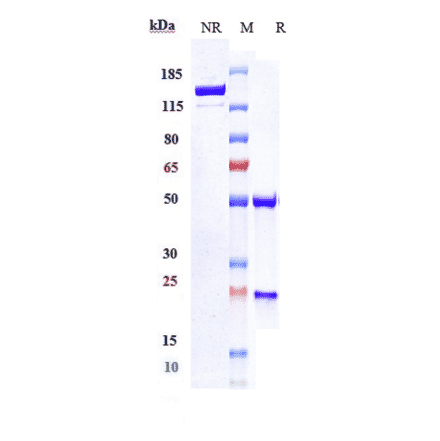 SDS-PAGE - Depatuxizumab Biosimilar - Anti-EGFR Antibody - Low endotoxin, Azide free (A323391) - Antibodies.com