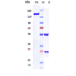 SDS-PAGE - Depatuxizumab Biosimilar - Anti-EGFR Antibody - Low endotoxin, Azide free (A323391) - Antibodies.com