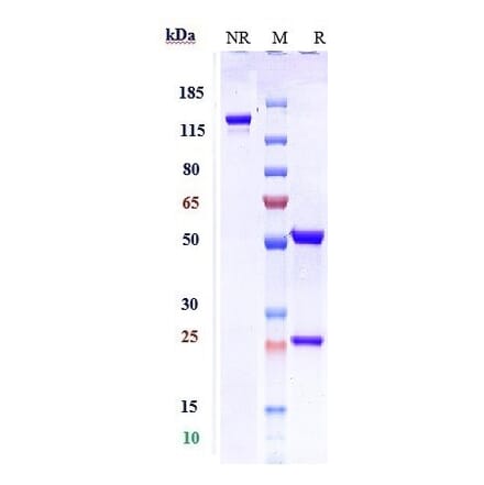 SDS-PAGE - Depemokimab Biosimilar - Anti-IL-5 Antibody - Low endotoxin, Azide free (A323392) - Antibodies.com