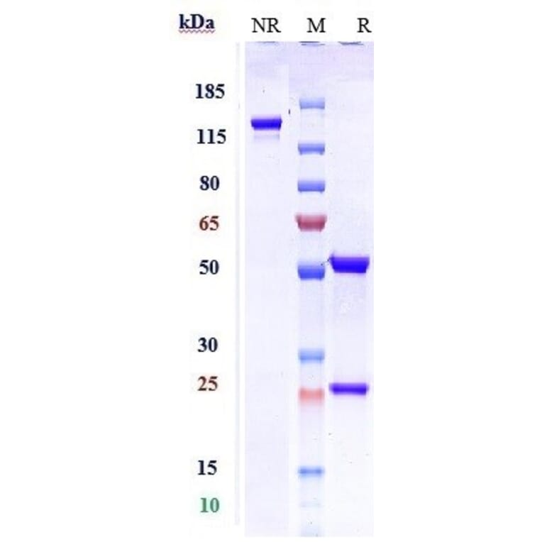 SDS-PAGE - Depemokimab Biosimilar - Anti-IL-5 Antibody - Low endotoxin, Azide free (A323392) - Antibodies.com