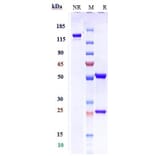 SDS-PAGE - Depemokimab Biosimilar - Anti-IL-5 Antibody - Low endotoxin, Azide free (A323392) - Antibodies.com