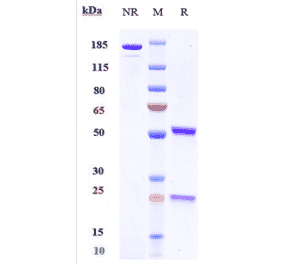 SDS-PAGE - Dezamizumab Biosimilar - Anti-Serum Amyloid P Antibody - Low endotoxin, Azide free (A323394) - Antibodies.com