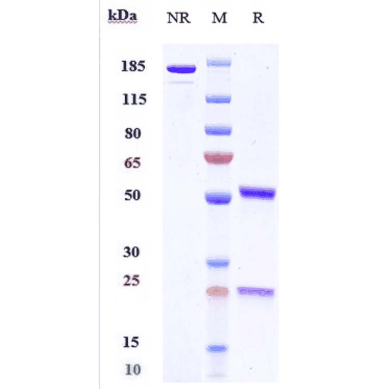 SDS-PAGE - Dezamizumab Biosimilar - Anti-Serum Amyloid P Antibody - Low endotoxin, Azide free (A323394) - Antibodies.com