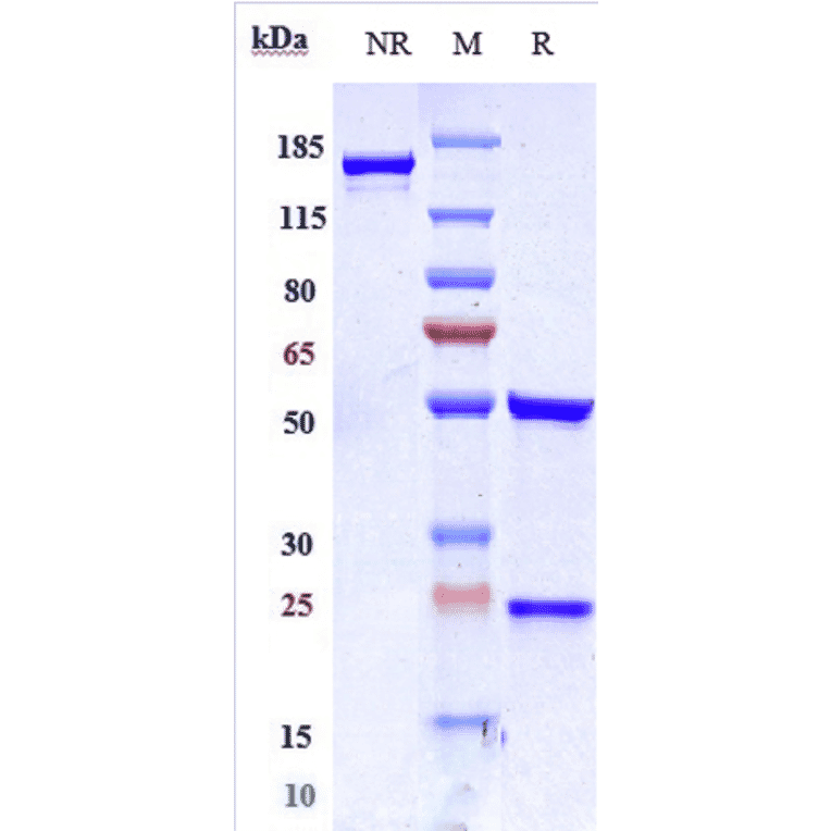 SDS-PAGE - Disitamab Biosimilar - Anti-ErbB2/HER2 Antibody - Low endotoxin, Azide free (A323397) - Antibodies.com