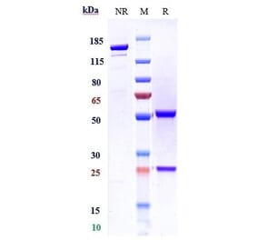 SDS-PAGE - Divozilimab Biosimilar - Anti-CD20 Antibody - Low endotoxin, Azide free (A323398) - Antibodies.com